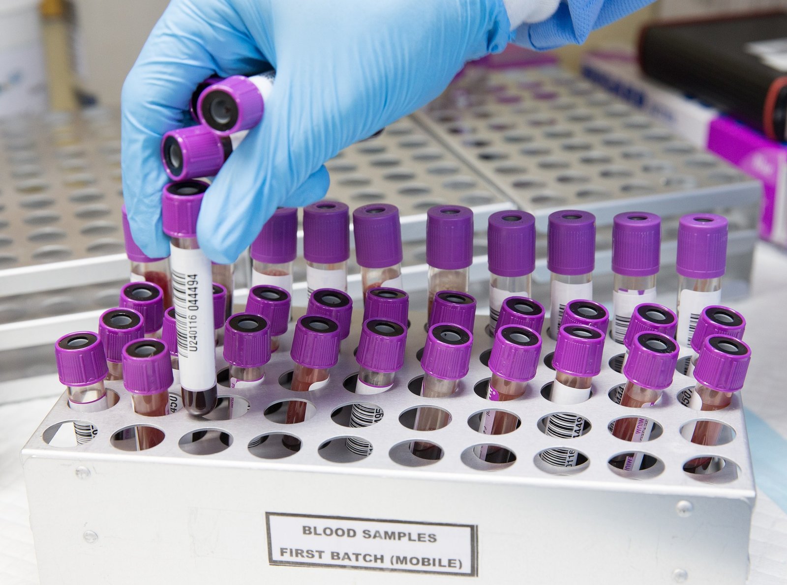 Servicio de Bioquímica en CEIBIO S.A.C.
